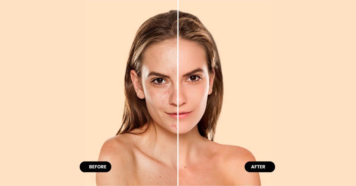 Xr:d:DAF_0ux7qtA:525,j:6461962212127563006,t:24032405